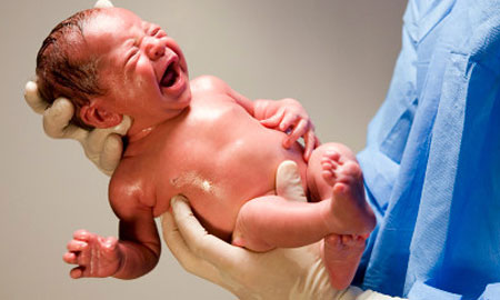  Асфиксия новорожденных-причина активности клебсиеллы 
