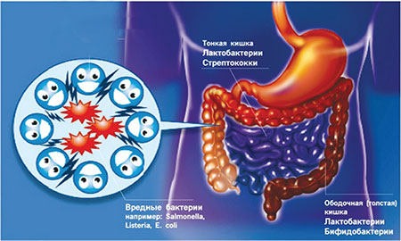 Дисбактериоз кишечника может быть осложнением колик