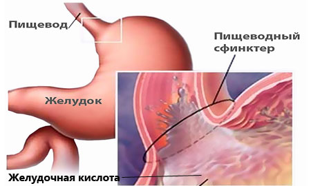 Как вылечить желудочно кишечный тракт ребенка thumbnail