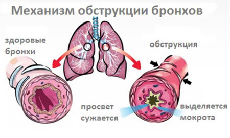Проблемы болезней органов дыхания у детей thumbnail